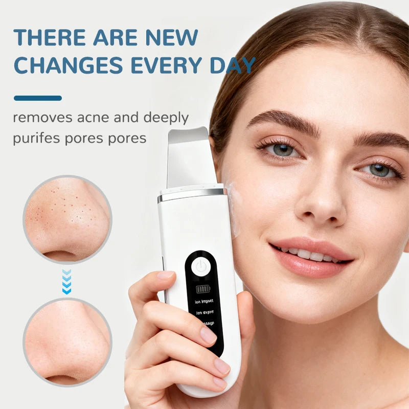 PorePolish Ultrasonic Skin Spatula